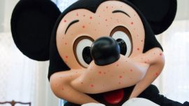 mickey_mouse_measles